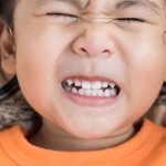 10 Tips Mengatasi Masalah Gigi Susu pada Anak