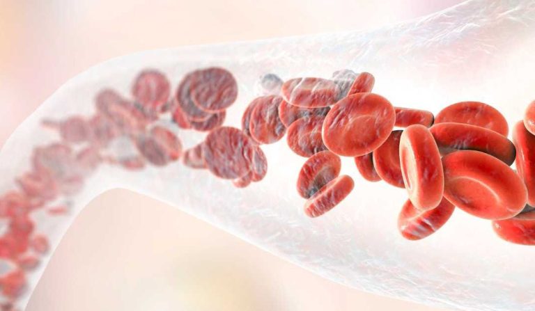 5 Panduan Memilih Suplemen untuk Kesehatan Pembuluh Darah