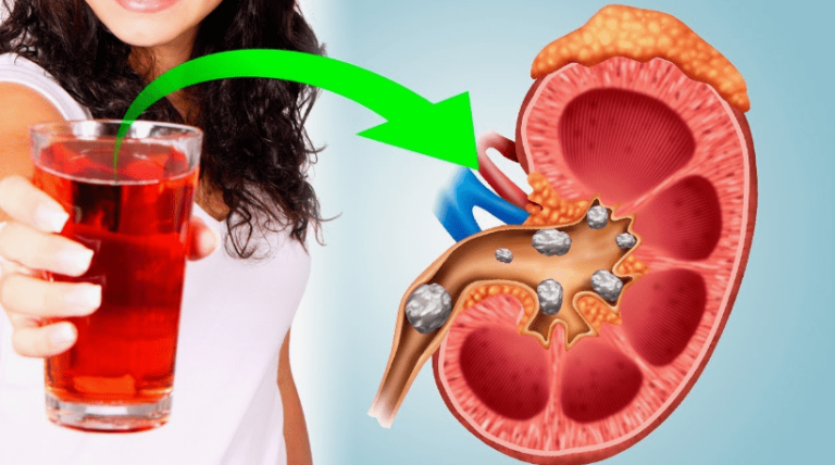 7 Minuman yang Menyehatkan Ginjal Anda Setiap Hari