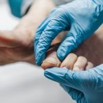 10 Tanda Kaki Anda Membutuhkan Perawatan Medis