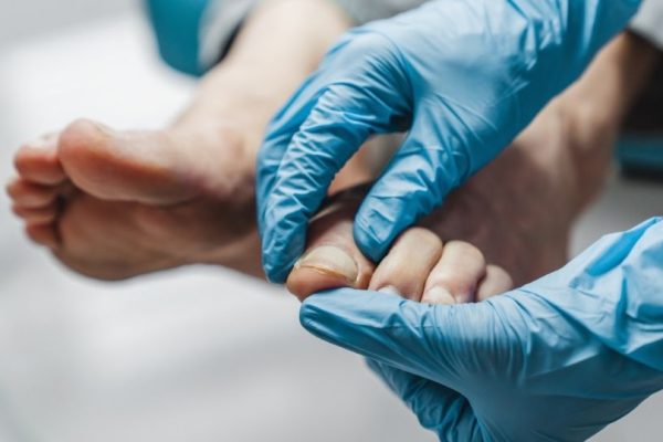 10 Tanda Kaki Anda Membutuhkan Perawatan Medis