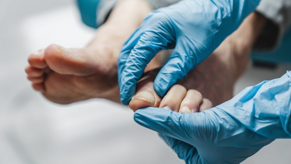 10 Tanda Kaki Anda Membutuhkan Perawatan Medis