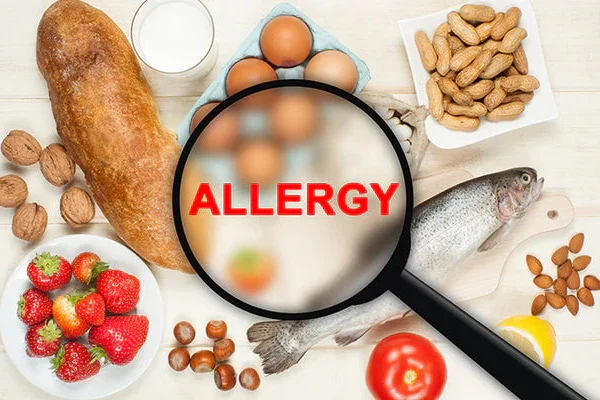 10 Tips Mengatasi Alergi Makanan dengan Aman