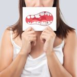 7 Kebiasaan Buruk yang Harus Dihindari Demi Gigi Sehat