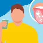 5 Tips Mengatasi Lidah Putih Secara Alami