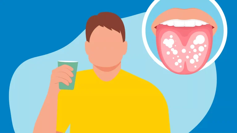 5 Tips Mengatasi Lidah Putih Secara Alami