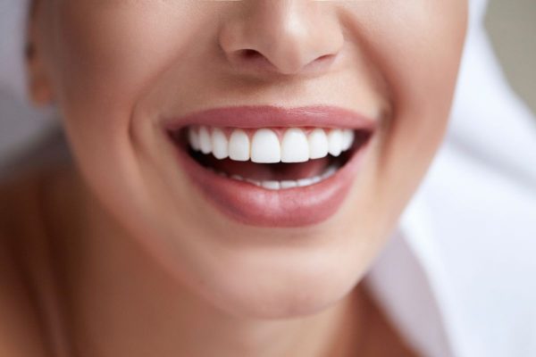 7 Cara Alami Memutihkan Gigi di Rumah